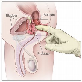 male g-spot diagram where to find a mens g-spot